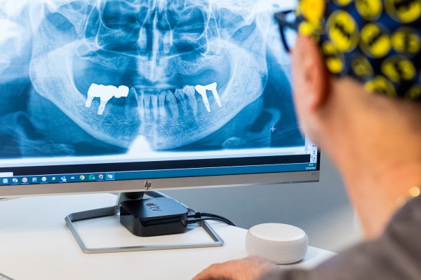 De Faveri-307 De Faveri-307