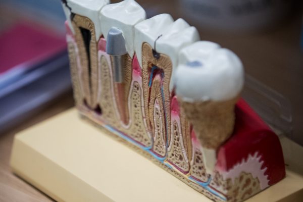 De Faveri-82 De Faveri-82